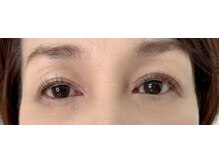 アメリオレフチュール(ameliorer futur)/進化系高濃度トリートメント