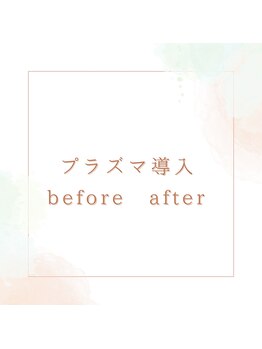 オレンジ(Orange)/