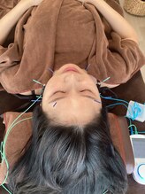 ハリファ鍼灸院 横浜関内院(HariFa鍼灸院)/美容施術