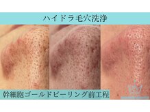 リメイククリニカルビューティー(Remake clinical beauty)/余分な物は取り除く