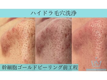 リメイククリニカルビューティー(Remake clinical beauty)/余分な物は取り除く