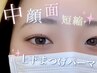★小顔効果＋面長解消◎まつげパーマ【上下セット】　￥13,200→￥8,690