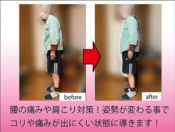 健美庵/姿勢改善で調子を整える！