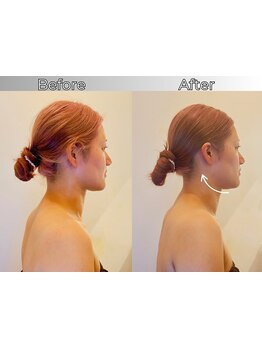 小顔になりたい