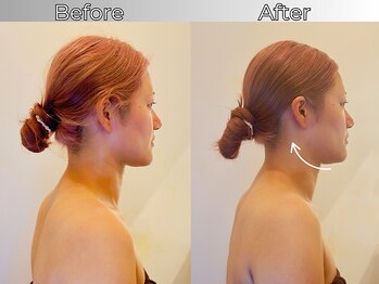 リストアハート(Restore Heart)の写真/変化にビックリ!?驚きの小顔施術が吉祥寺で叶う!お顔のハリやむくみ、歪みを整え理想のフェイスラインに◎