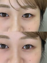 ソリン(Solin')/まつげパーマ