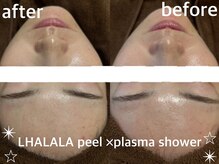 グランクウォーレ(Gran Cuore)/ララピール×プラズマシャワー☆