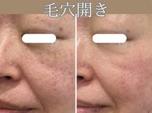 ハウオリ(HAUOLI)/毛穴がキュッと。