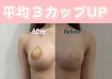 ロザリア(ROSALIA)