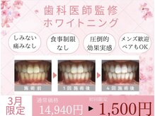 ホワイトニングカフェ 岡崎店(WhiteningCafe)の雰囲気（【ご新規様限定】お得クーポン有り！通常14,940円→1,500！）