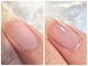 アッソ ネイル(ASSO Nail)の写真/割れやすい/ささくれ/縦筋/凹凸...こんな悩み持つ方へ。サロン品質の爪ケアを体験しましょう!