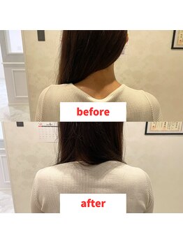 ナオル整体 福岡香椎院(NAORU整体)/20代女性施術事例【体の歪み】