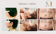 モリコ コンフィデントビューティーサロン(Moriko Confident Beauty Salon)