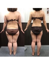 オンディーヌ 名古屋/劇的に!! &nbsp;