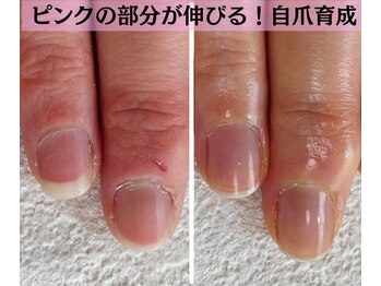 ケアで育成３ヶ月☆