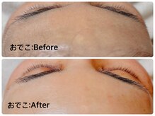 プルンプァン 北千住店(pulun-puan)/おでこのシェービング