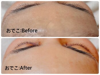 プルンプァン 北千住店(pulun-puan)/おでこのシェービング