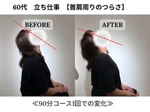 240鍼灸マッサージ院 麻布十番/１回の施術　ビフォーアフター