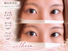 アンテイン(anthein)