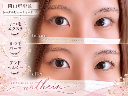 アンテイン(anthein)の写真