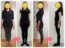 KWS股関節ウォーキングスタジオ/【2】腰痛、便秘改善(30代・OL)