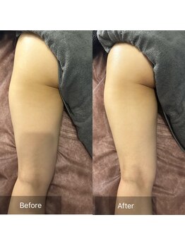 フフラ KANコルギセラピー山梨本店(fufla)/【ウルトランスフォーマー】