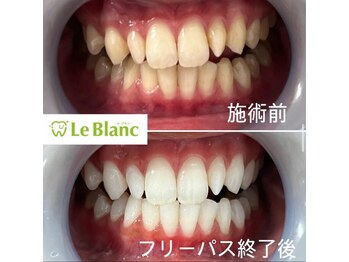 ルブラン 奈良店(Le Blanc)/ご新規様増えてます！
