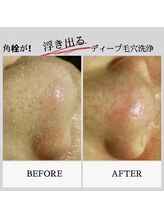 フルーヴ ルフレ(Fleuve Reflet)/角栓が固くなる冬はサロンでケア