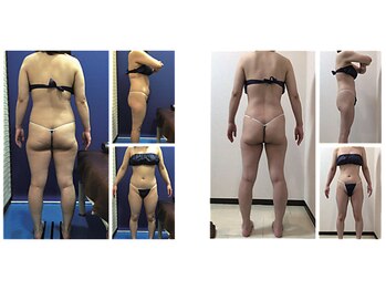 ミネルバエンダモロジー/エンダモロジー/痩身/ウェルネス