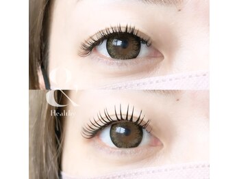 エタニティー(Eternity)/バインドロック+アンドヘルシー