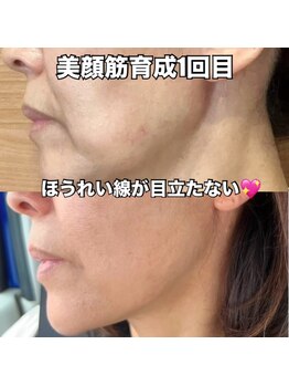 リエル(RIEL)/【美顔筋育成】