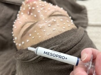 ウルル(ULuLu)/iLLON メソプロプラス