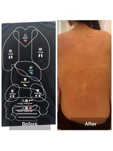 サロンドデュイ/1回施術/20代/トーンヌール