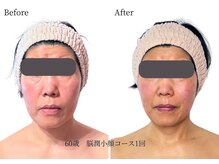 エステティックサロン ドゥネールの雰囲気（お悩みは頬のもたつき！一人一人に合わせたオーダーメイド！）
