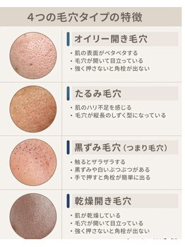 ルクス 新小岩店(Lux)/毛穴タイプ