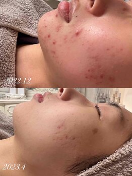 リッチ(Rich)/お悩み解消