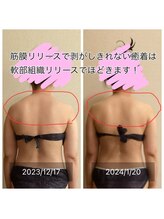 カレン/軟部組織のリリース