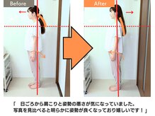 リップル オステオパシー整体院(RIPPLE)/姿勢の変化4