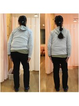 平川鍼灸接骨院 小堀院/猫背矯正