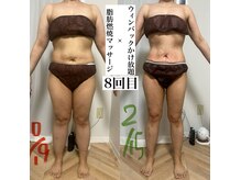 アモ(amo.)/ウィンバック×燃焼マッサージ