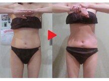 アンジェリーク/溶ける脂肪燃焼サイズダウン60分