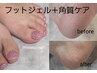フット◆すべすべかかと【角質ケア】+ワンカラーorラメグラ10,300