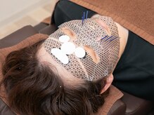 かわ鍼灸整体サロン/極上パックで肌改善