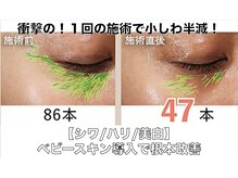 ボディアーキ 吉祥寺店(BODY ARCHI)/【シワ/ハリ/美白】根本改善