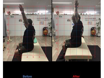 ストレチックス 近江八幡店/肩痛改善ビフォーアフター1回