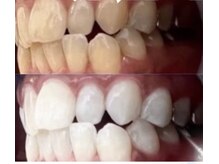 ホワイト 香里園店(WHITE)/3ヶ月後の変化《50代》