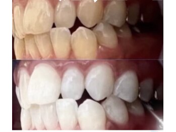 ホワイト 香里園店(WHITE)/3ヶ月後の変化《50代》