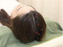 丸太町骨盤整骨院 鍼灸院/頭痛セラピー・鍼・肩こり・腰痛