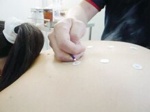 アタック鍼灸院(ATAC鍼灸院)の雰囲気(お灸で身体の機能回復!鍼灸/首こり/肩こり/腰痛/眼精疲労/整体)