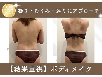 ラナビューティリゾート(Lana Beauty resort)の写真/【BODY|身体のラインと巡りを整える】筋膜リリース×ラジオ波★